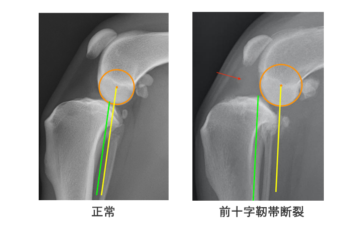 前十字靭帯断裂 | どうぶつ病院京都 四条堀川｜京都市どうぶつ病院京都
